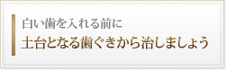 白い歯を入れる前に
土台となる歯ぐきから治しましょう