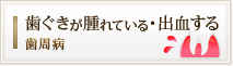 歯ぐきが腫れている・出血する
歯周病